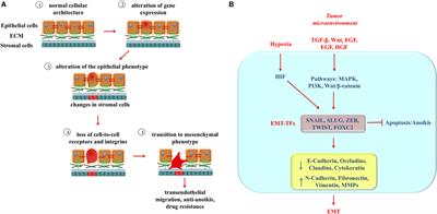 Mitochondrial Dysfunction: A Novel Potential Driver of Epithelial-to-Mesenchymal Transition in Cancer